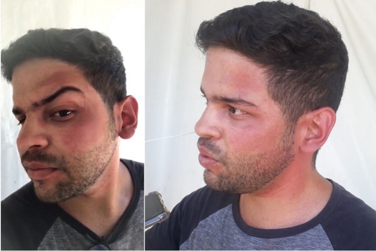 Jornalista sergipano é agredido por funcionário da prefeitura de Paulo Afonso