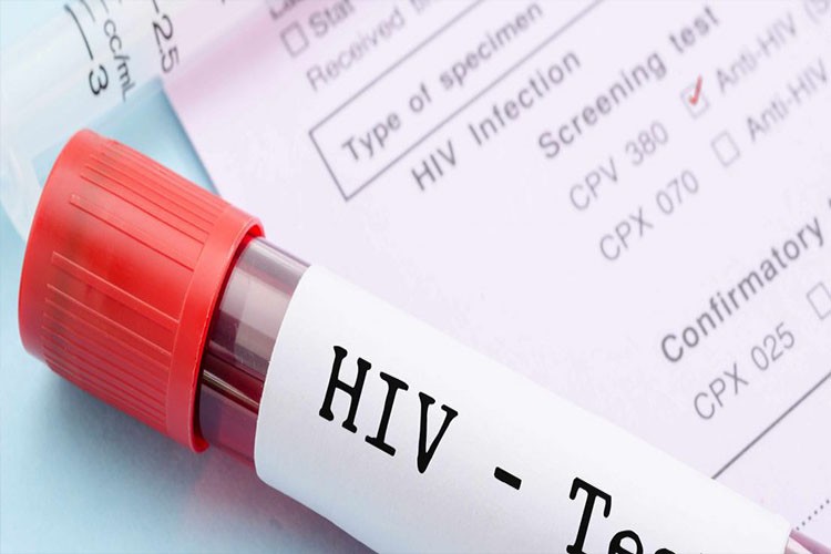 Teste rápido para HIV já está à venda em farmácias brasileiras